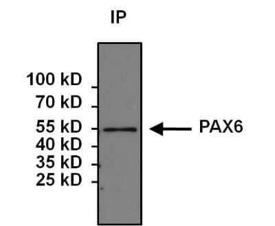 Immunoprecipitation: Pax6 Antibody [NB300-750]
