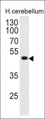 Western Blot: Pax6 Antibody (PAX6/498) [NBP2-32893]