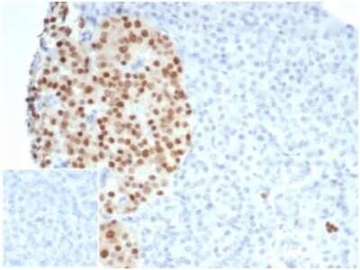 Immunohistochemistry-Paraffin: Pax6 Antibody (PAX6/7078R) [NBP3-13988]