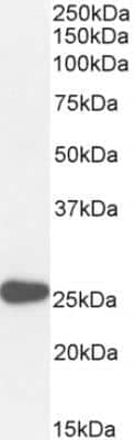 Western Blot: Pax6 Antibody [NB100-61654]