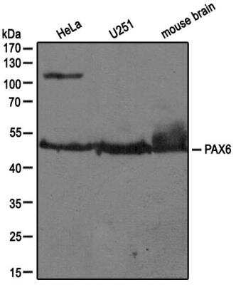 Western Blot: Pax6 Antibody [NB300-750]