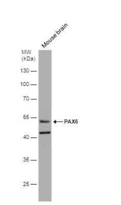Western Blot: Pax6 Antibody [NBP2-19711]