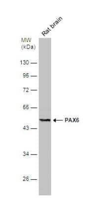 Western Blot: Pax6 Antibody [NBP2-19711]