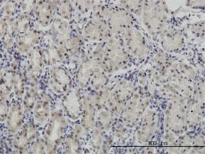 Immunohistochemistry-Paraffin: Pax7 Antibody (1E12) [H00005081-M05]