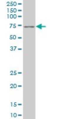 Western Blot: Pax7 Antibody (1G11) [H00005081-M07]