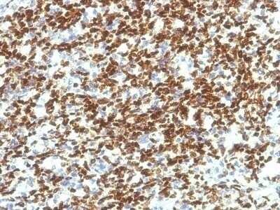 Immunohistochemistry-Paraffin: Pax7 Antibody (PAX7/1187) - Azide and BSA Free [NBP2-47922]