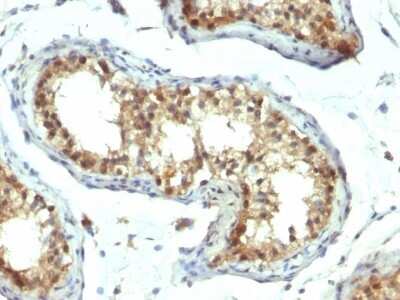 Immunohistochemistry-Paraffin: Pax7 Antibody (PAX7/1187) - Azide and BSA Free [NBP2-47922]