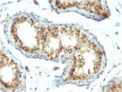 Immunohistochemistry-Paraffin: Pax7 Antibody (PAX7/1187) - IHC-Prediluted [NBP2-48248]