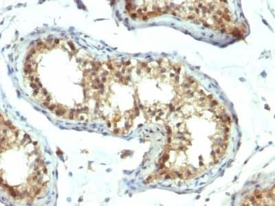 Immunohistochemistry-Paraffin: Pax7 Antibody (PAX7/1187) [NBP2-44588]