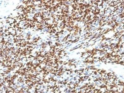 Immunohistochemistry-Paraffin: Pax7 Antibody (SPM613) - Azide and BSA Free [NBP2-47923]