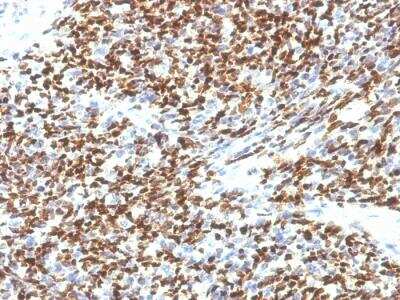 Immunohistochemistry-Paraffin: Pax7 Antibody (SPM613) - IHC-Prediluted [NBP2-48249]