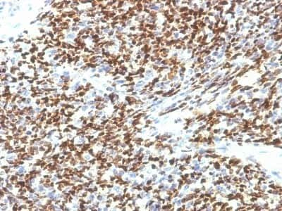 Immunohistochemistry-Paraffin: Pax7 Antibody (SPM613) [NBP2-44589]