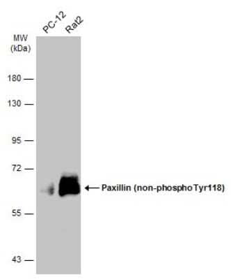 Western Blot: Paxillin Antibody (GT722) [NBP3-13562]