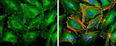 Immunocytochemistry/ Immunofluorescence: Paxillin Antibody (GT7612) [NBP3-13563]