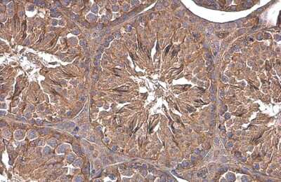 Immunohistochemistry-Paraffin: Paxillin Antibody (GT7612) [NBP3-13563]