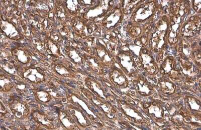 Immunohistochemistry-Paraffin: Paxillin Antibody (GT7612) [NBP3-13563]