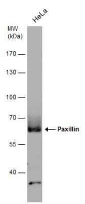 Western Blot: Paxillin Antibody (GT7612) [NBP3-13563]