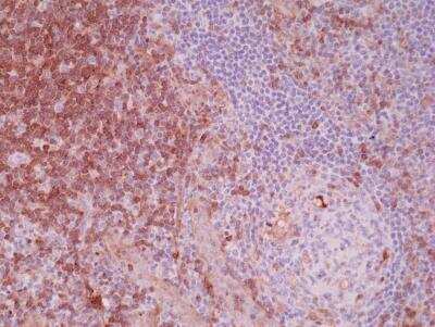 Immunohistochemistry-Paraffin: Paxillin Antibody (RM256) [NBP2-61576]