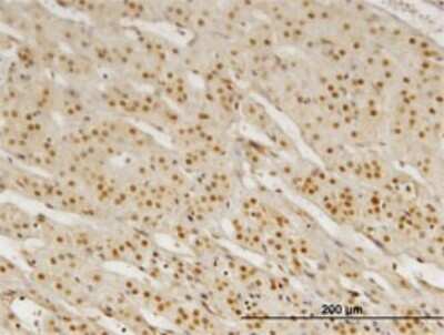 Immunohistochemistry-Paraffin: Pbx3 Antibody (1A11) [H00005090-M02]
