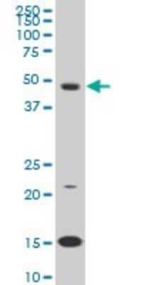 Western Blot: Pbx3 Antibody (1A11) [H00005090-M02]