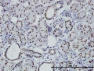 Immunohistochemistry-Paraffin: Pbx3 Antibody (1A9) [H00005090-M01]