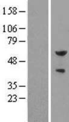 Western Blot: Pea3 Overexpression Lysate [NBL1-10360]