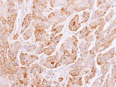 Immunohistochemistry-Paraffin: Peflin Antibody [NBP1-31613]