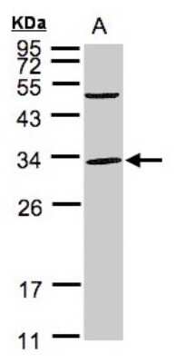 Western Blot: Peflin Antibody [NBP1-31613]