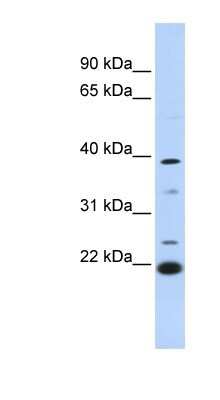 Western Blot: Peflin Antibody [NBP1-56935]