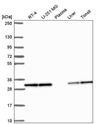 Western Blot: Peflin Antibody [NBP2-56626]