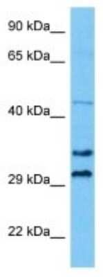 Western Blot: Peflin Antibody [NBP3-10081]