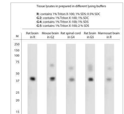 Western Blot: Pejvakin Antibody [NB110-75015]