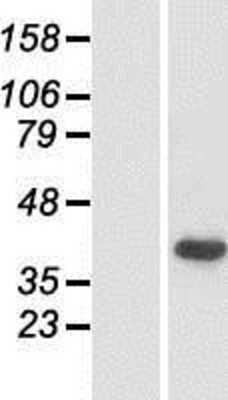 Western Blot: Pejvakin Overexpression Lysate [NBP2-10663]