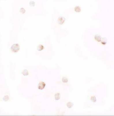 Immunocytochemistry/ Immunofluorescence: Pellino 1 Antibody - BSA Free [NBP2-81888]