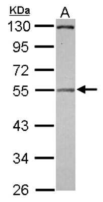 Western Blot: Pellino 2 Antibody [NBP2-15068]