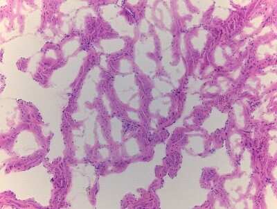 Hematoxylin & Eosin Stain: Penis Tissue Slides (Adult Normal)- Frozen [NBP2-77553]