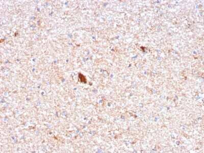 Immunohistochemistry-Paraffin: Pentraxin 2/SAP Antibody (APCS/3240) [NBP2-79714]