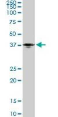 Western Blot: Pentraxin 3/TSG-14 Antibody (2B10) [H00005806-M02]