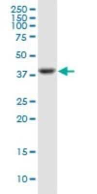 Western Blot: Pentraxin 3/TSG-14 Antibody (2B10) [H00005806-M02]