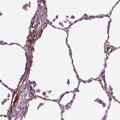 Immunohistochemistry-Paraffin: Pentraxin 3/TSG-14 Antibody [NBP2-49595]