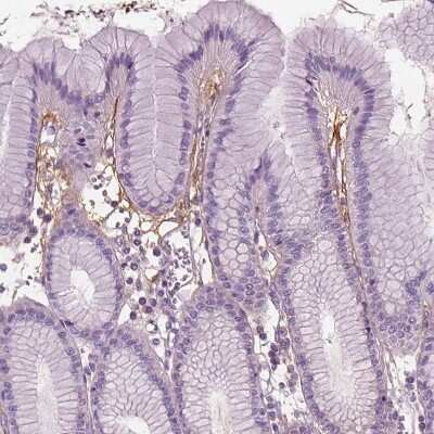 Immunohistochemistry-Paraffin: Pentraxin 3/TSG-14 Antibody [NBP2-49595]