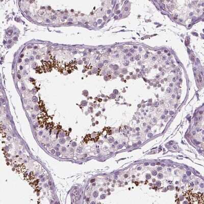 Immunohistochemistry-Paraffin: Pentraxin 3/TSG-14 Antibody [NBP2-49595]