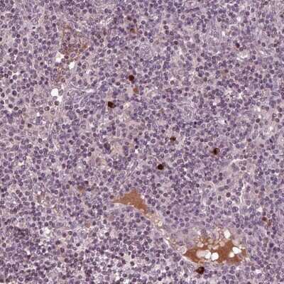 Immunohistochemistry: Pentraxin 4 Antibody [NBP2-68966]