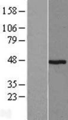 Western Blot: Pepsinogen A Overexpression Lysate [NBL1-14322]