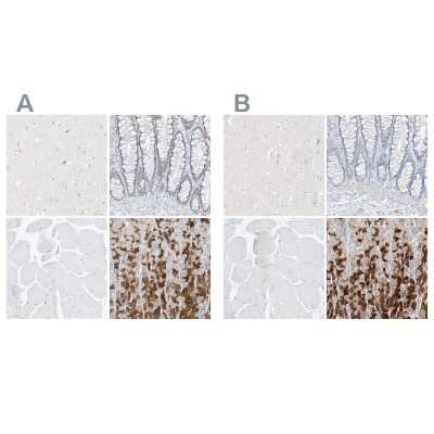 Immunohistochemistry-Paraffin: Pepsinogen C/PGC/Progastricsin Antibody [NBP1-91011]