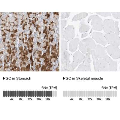 Immunohistochemistry-Paraffin: Pepsinogen C/PGC/Progastricsin Antibody [NBP1-91011]