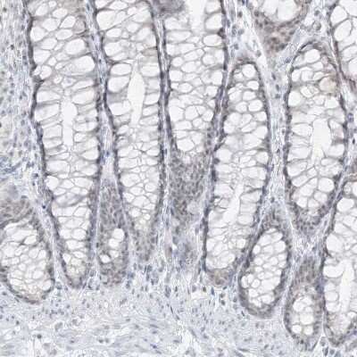 Immunohistochemistry-Paraffin: Pepsinogen C/PGC/Progastricsin Antibody [NBP1-91011]
