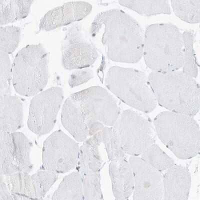 Immunohistochemistry-Paraffin: Pepsinogen C/PGC/Progastricsin Antibody [NBP1-91011]