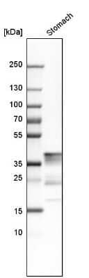 Western Blot: Pepsinogen C/PGC/Progastricsin Antibody [NBP1-91011]