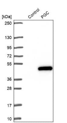 Western Blot: Pepsinogen C/PGC/Progastricsin Antibody [NBP1-91011]